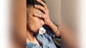 চলন্ত ট্রেনে ছোড়া পাথরে চার দাঁত ভাঙল যাত্রীর