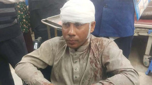 চৌদ্দগ্রামে জামায়াত-বিএনপির সংঘর্ষ, আহত ৭