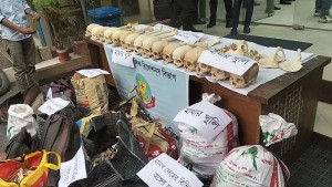 অনলাইনে মানুষের কঙ্কাল বিক্রি, জড়িত ডেন্টালের দুই ছাত্র: ডিএমপি